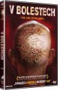 nahlad V bolestech - DVD
