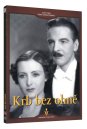 nahlad Krb bez ohně - DVD Digipack