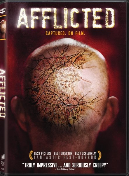 detail V bolestech - DVD